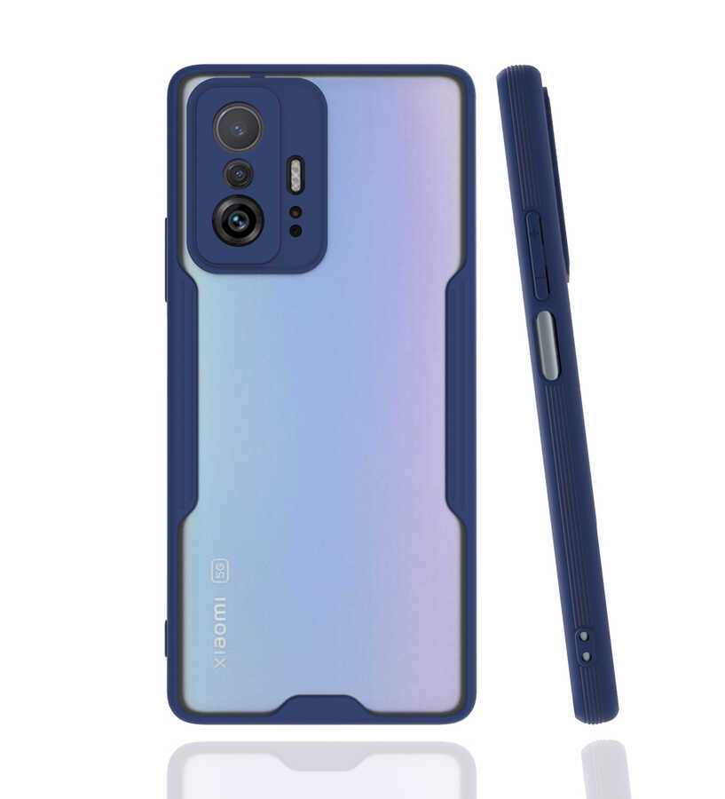 Xiaomi%20Uyumlu%20%20Mi%2011T%20Pro%205G%20Kılıf%20Zore%20Parfe%20Kapak-Lacivert